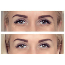 Wrinkle Recovery Eye Pad - thekamipad