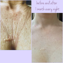 Wrinkle Recovery for Stretch Marks and Scars, Knee Gel Pad, Skincare Gift Set, Skin Hydration